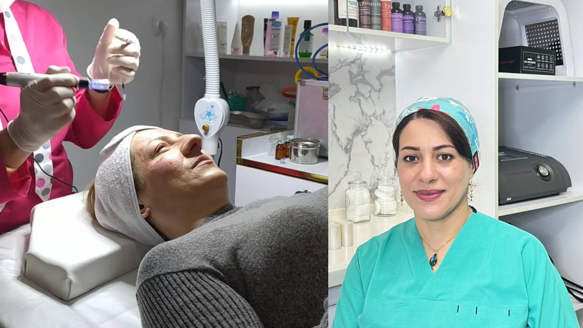 خال برداری تخصصی در ابریشم محله رامسر | حذف ایمن و زیبای خالها